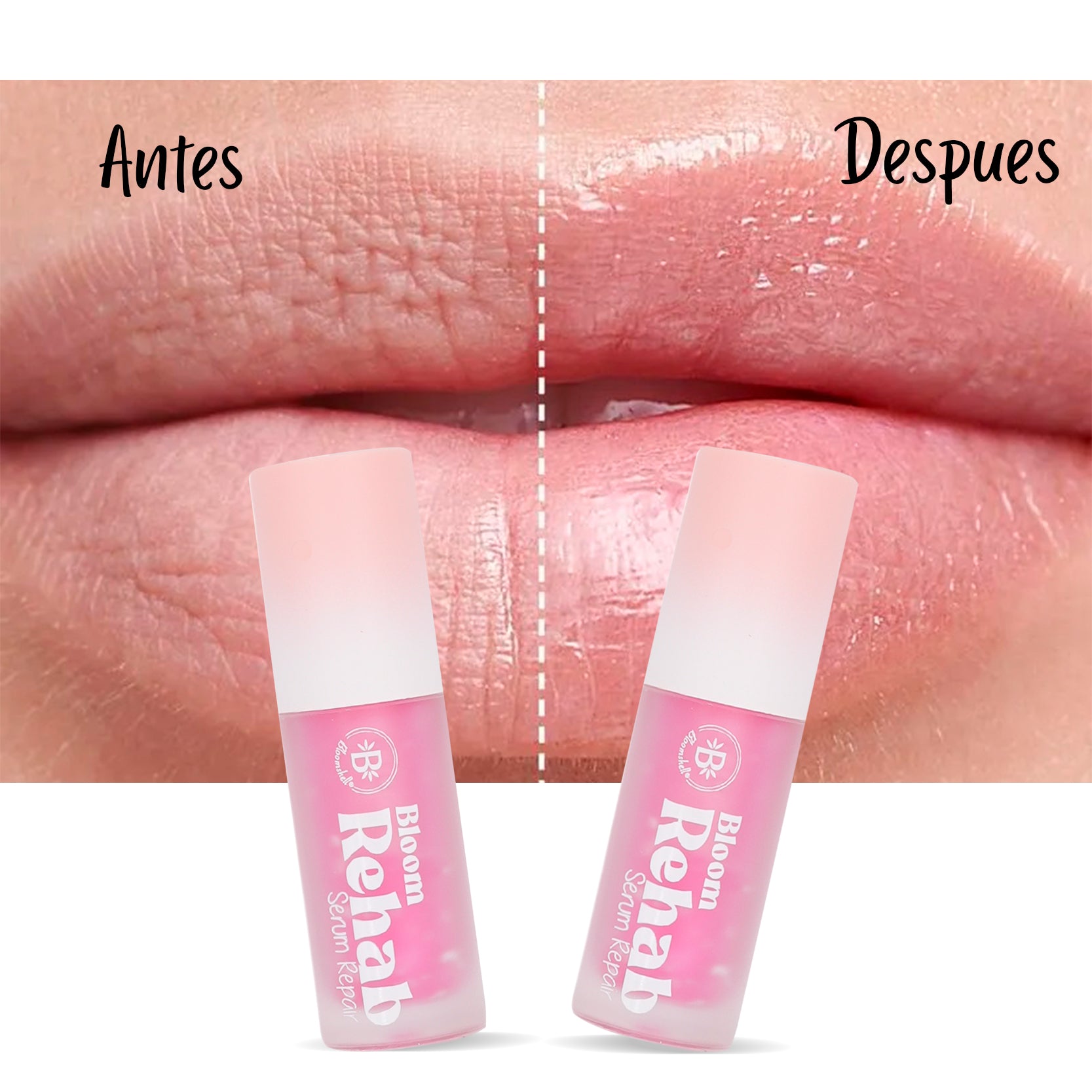 Serum Para Labios Rehab Bloomshell